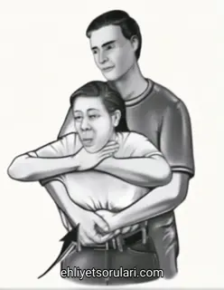heimlich manevrasi 1